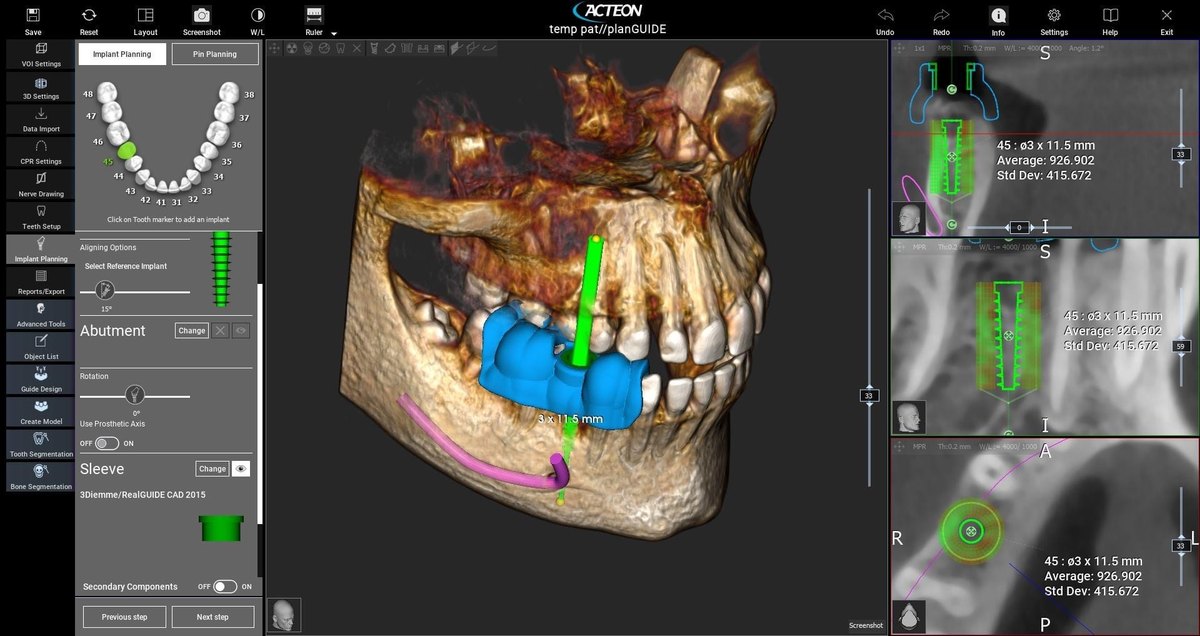Acteon Imaging Suite 5.4