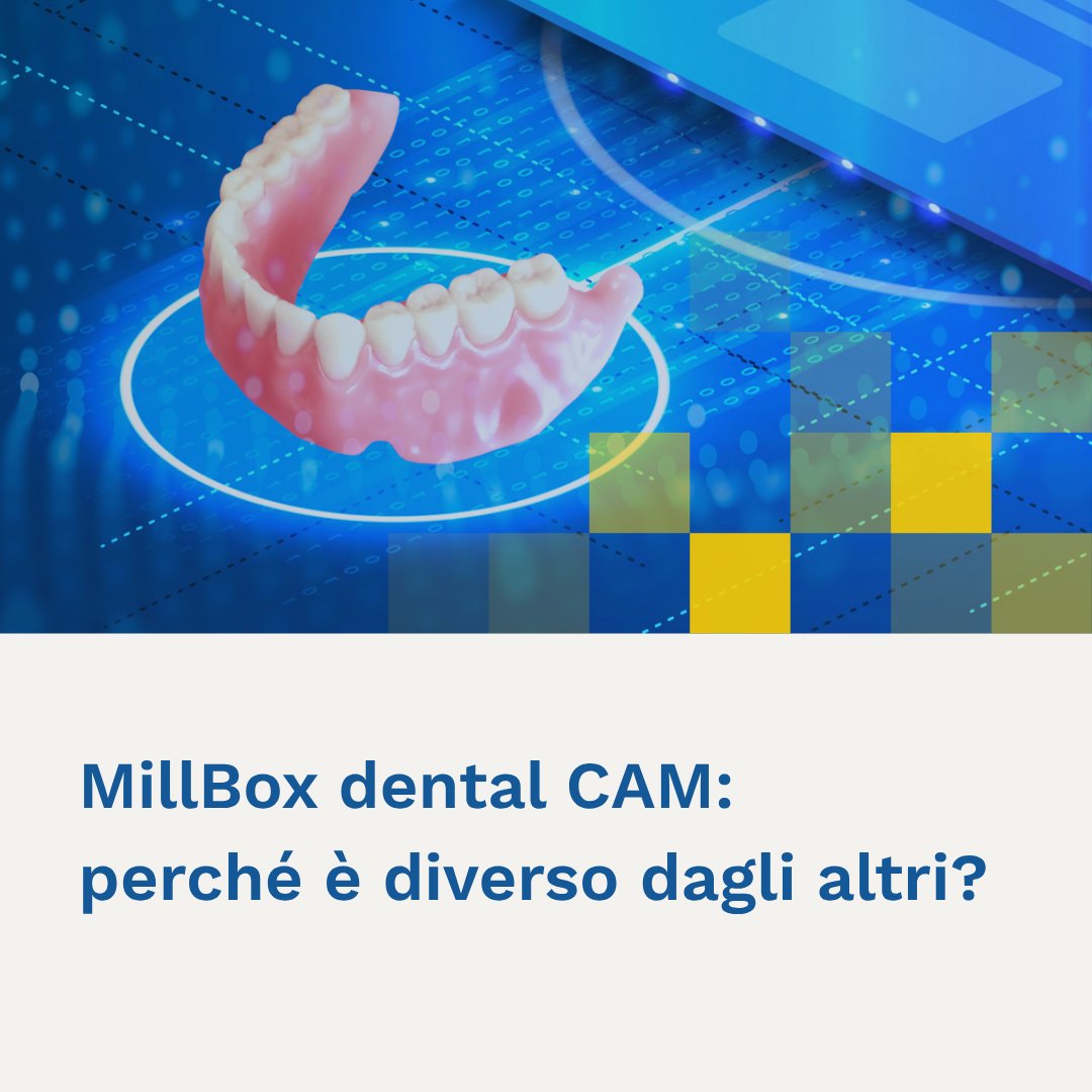 MillBox
