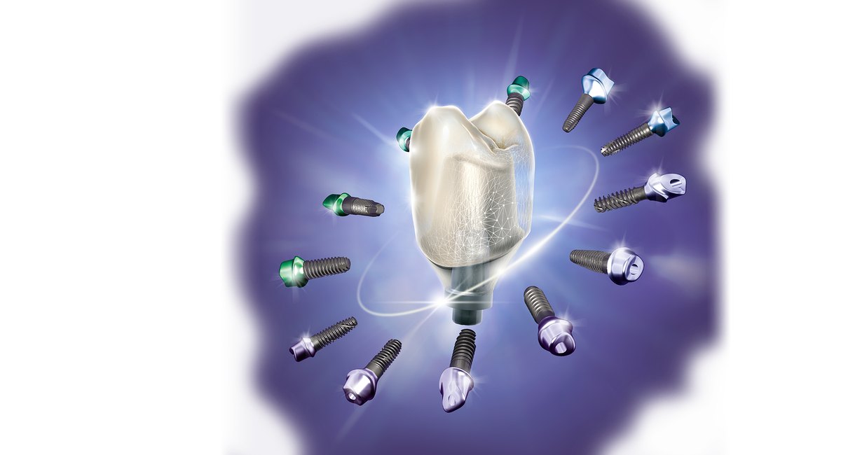 exocad DentalCAD